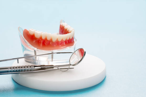 Best Dental Inlays and Onlays  in English, IN